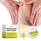 Ouhoe 100g Stretch Mark Removal Cream Maternity